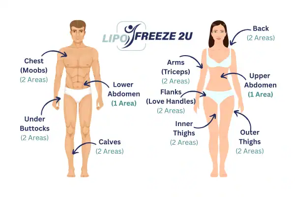 Areas you can have fat freezing treatment Durham