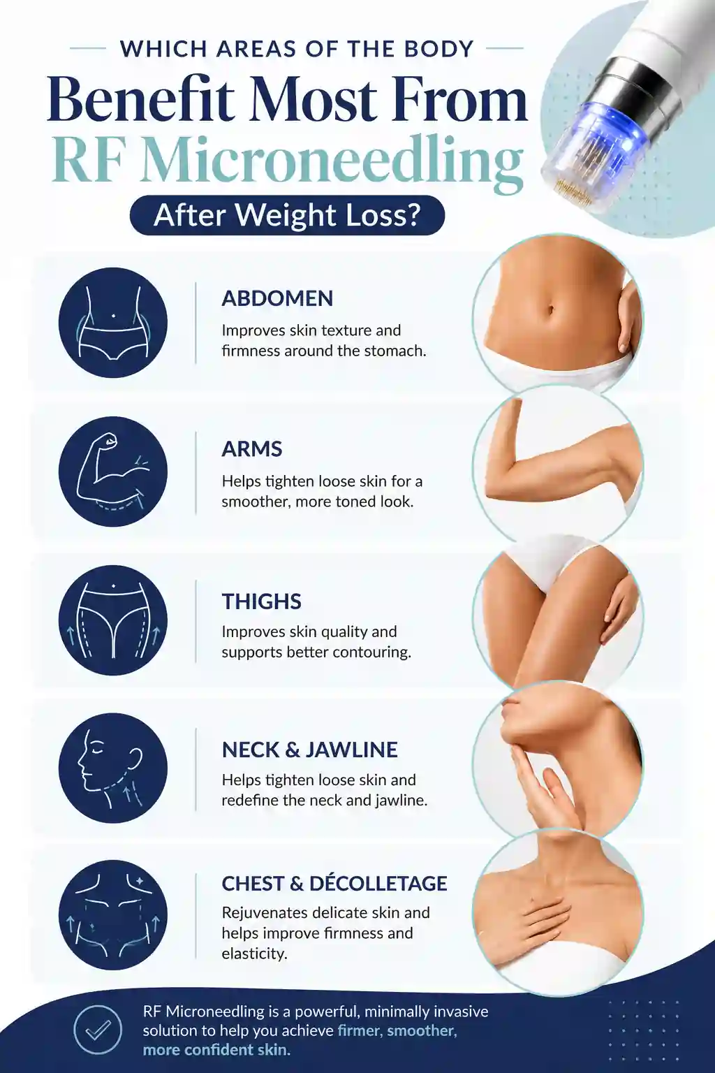 Which Areas of the Body Benefit Most From RF Microneedling After Weight Loss Durham